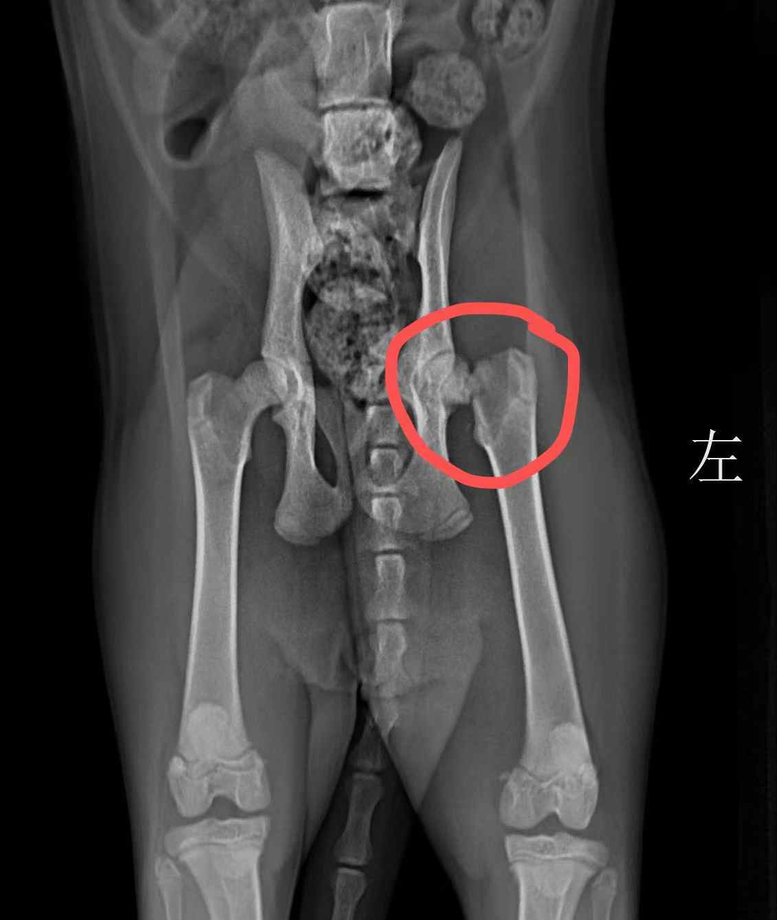 乐乐股骨颈损伤影像记录影像
