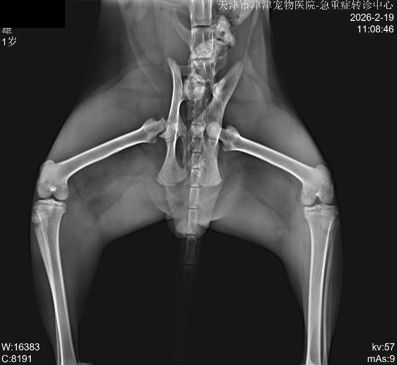 幸运骨盆损伤治疗影像影像