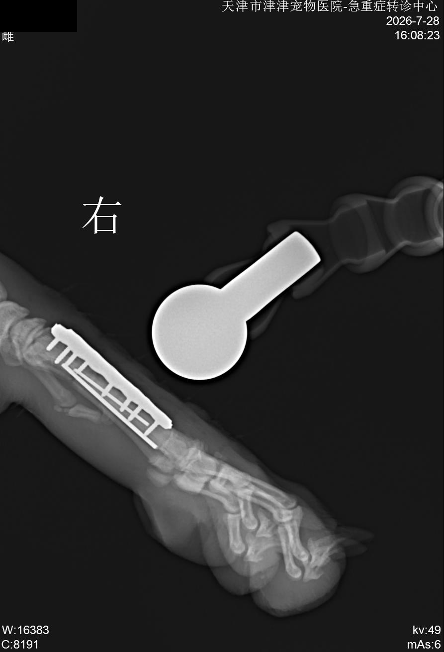 固定后侧位 · 同次检查